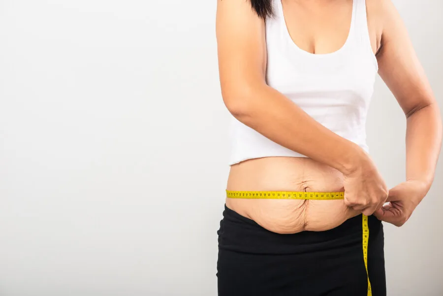 mommy-makeover-chirurgie-esthetique-apres-grossesse-dr-haddad-paris Mesure du ventre après une grossesse
