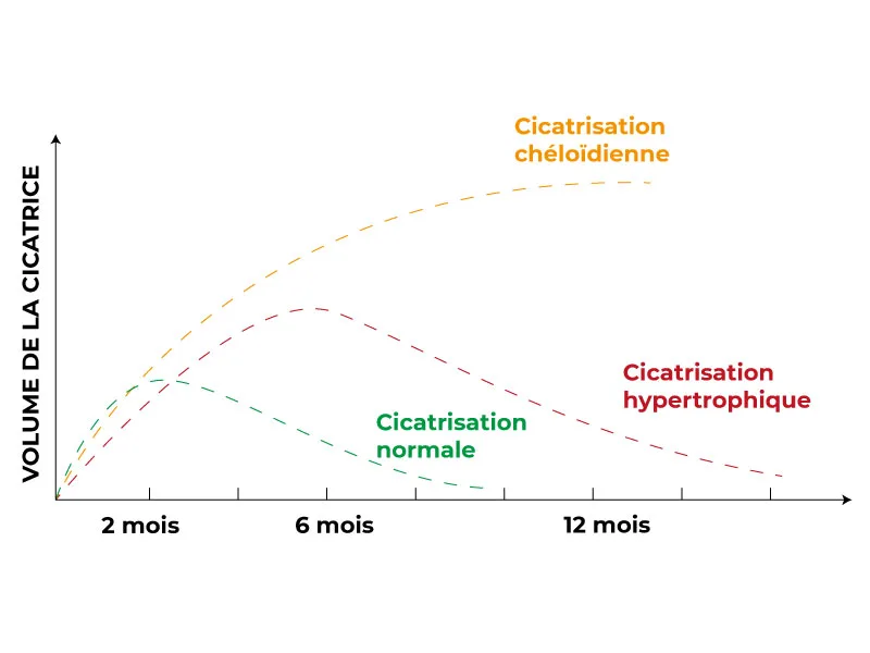 Schéma du processus de cicatrisation