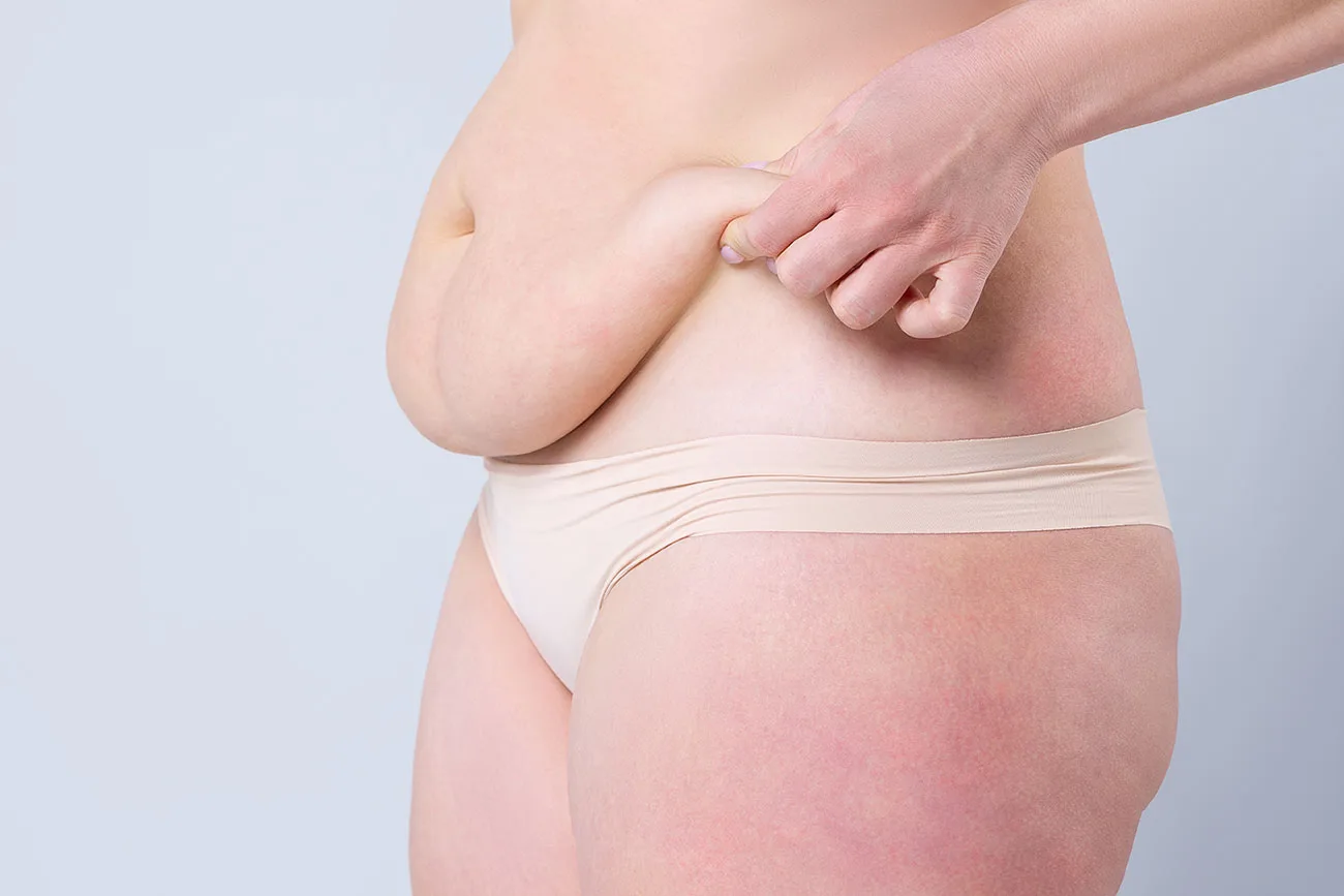 prise en charge abdominoplastie 2021