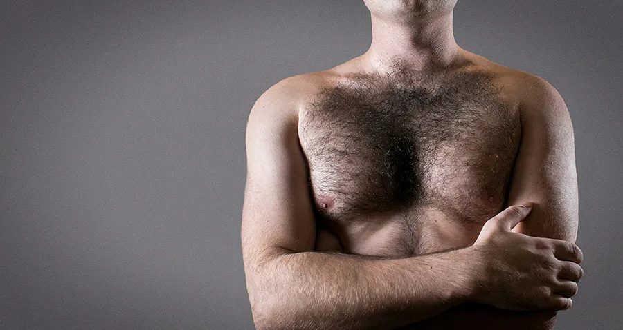 Homme présentant un développement du sein