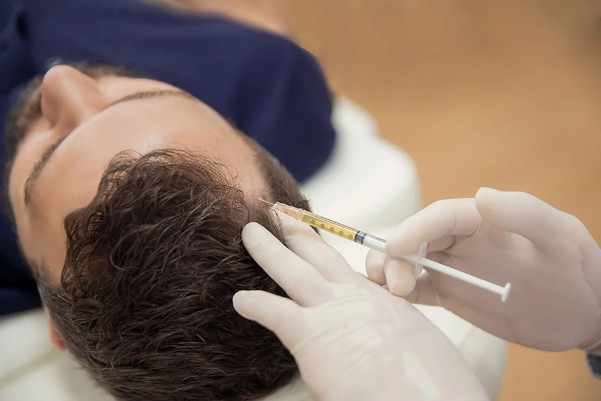 Injections de PRP cheveux pour homme