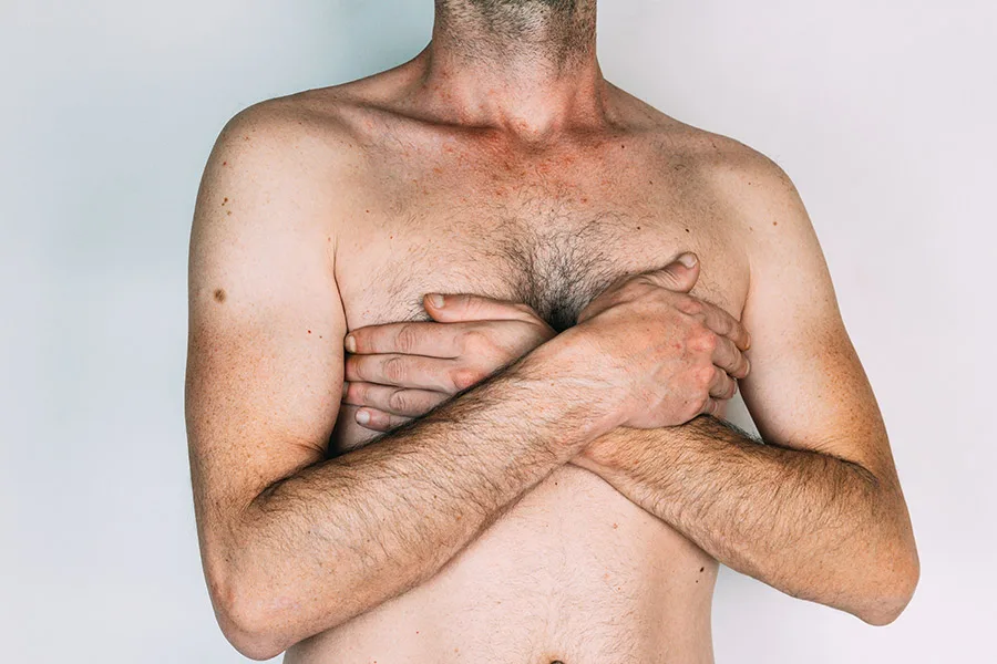 Gynecomastie ou adipomastie chez l'homme, les différences
