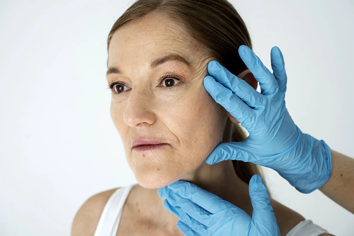 lifting-visage-docteur-haddad-chirurgien-paris cicatrices après lifting cervico-facial