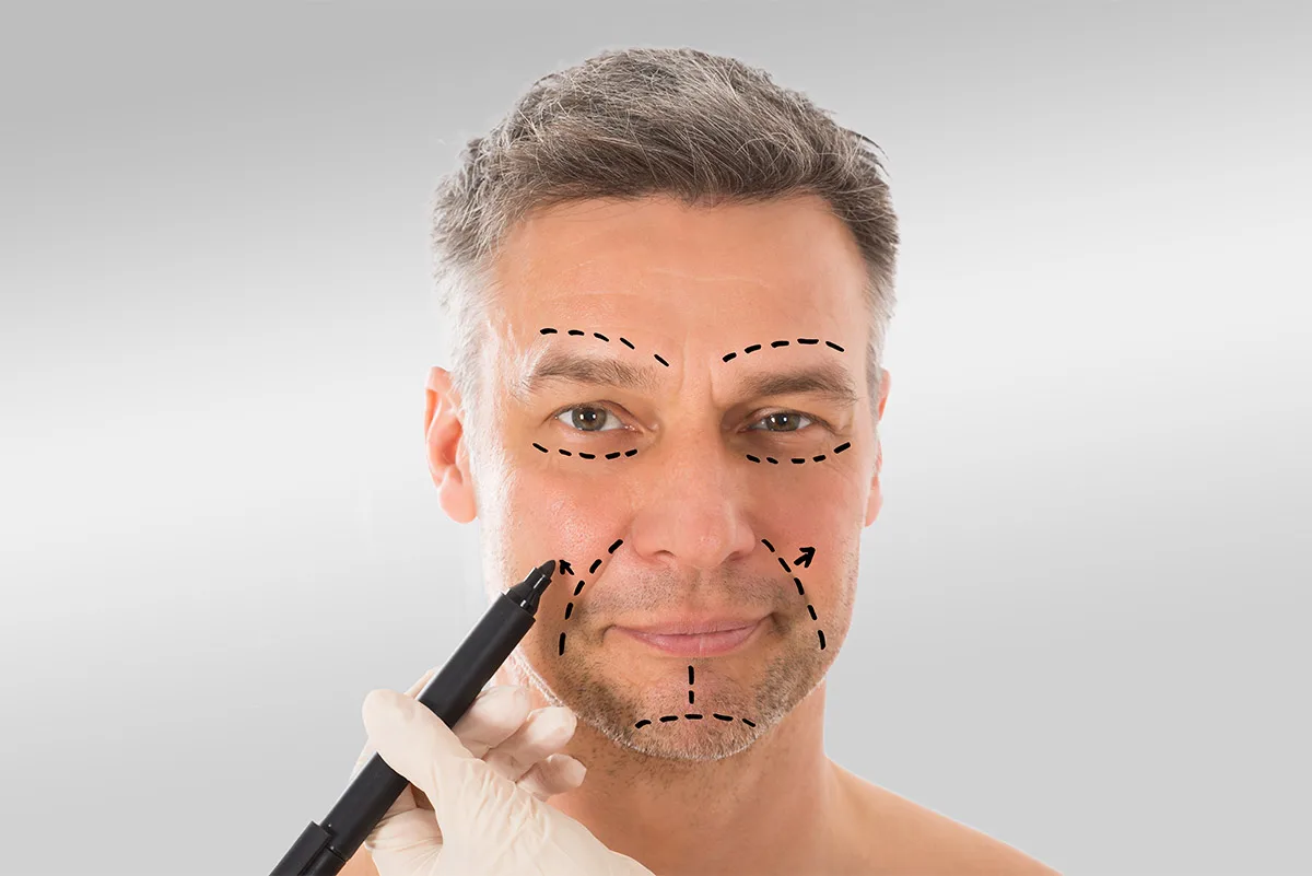 Lifting du visage pour homme
