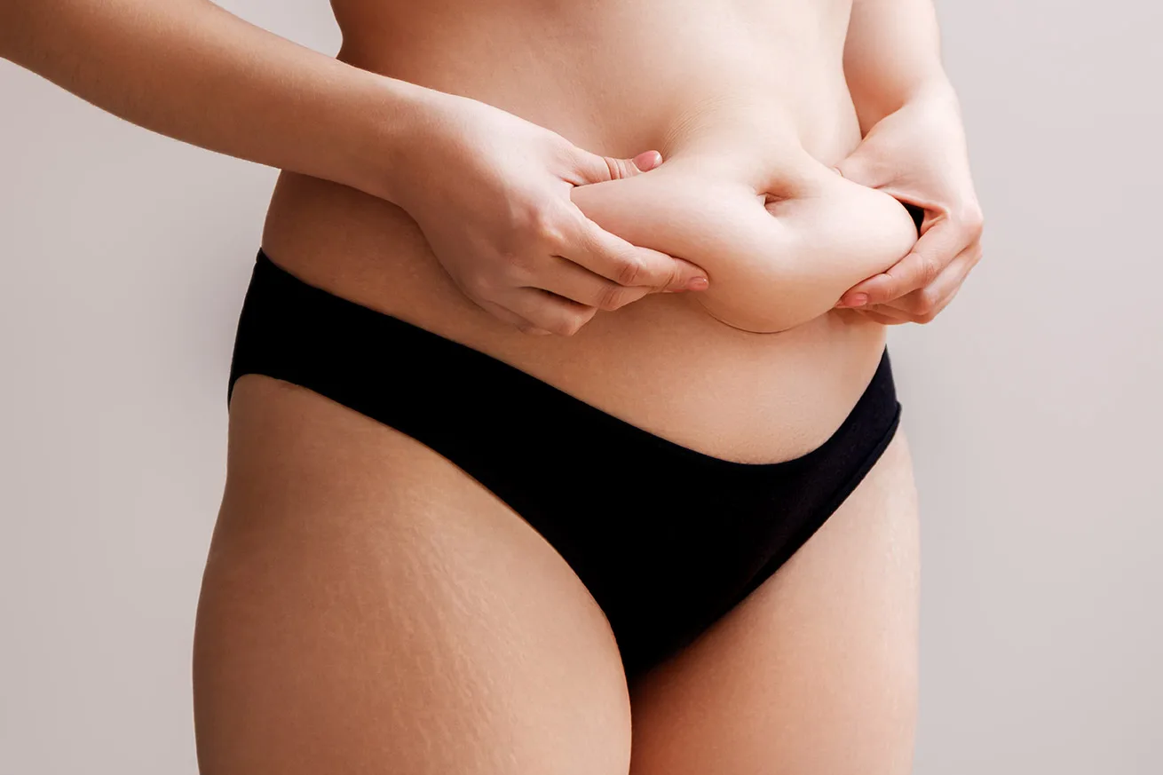 Liposuccion de la graisse du ventre