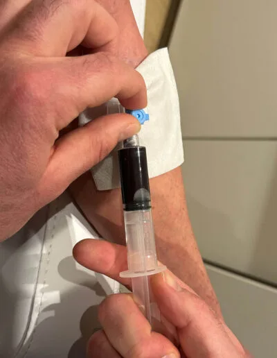 Prélèvement sanguin du patient avant PRP