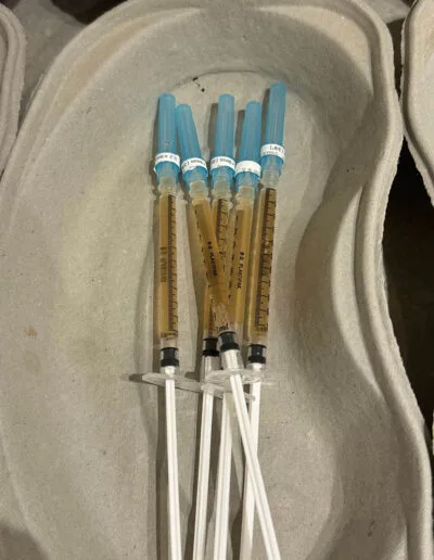 Seringues de plasma riche en plaquettes (PRP)