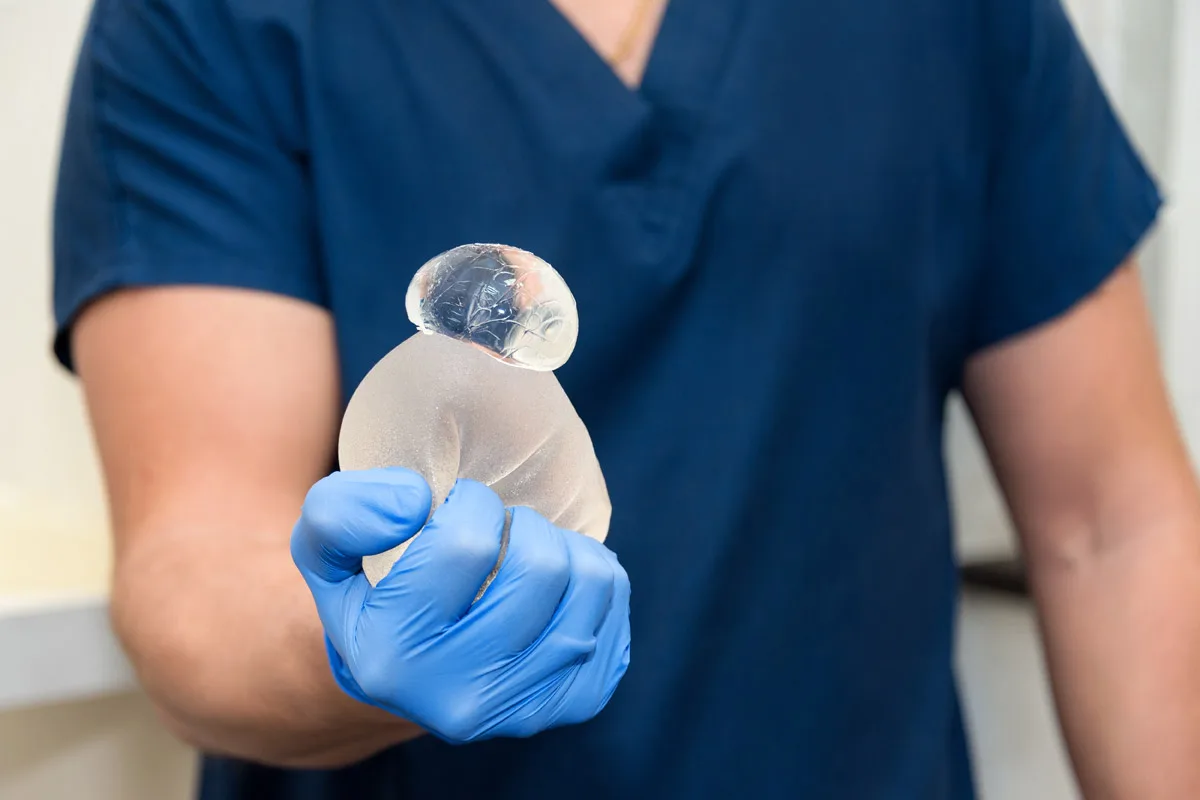 Rupture d'un implant mammaire