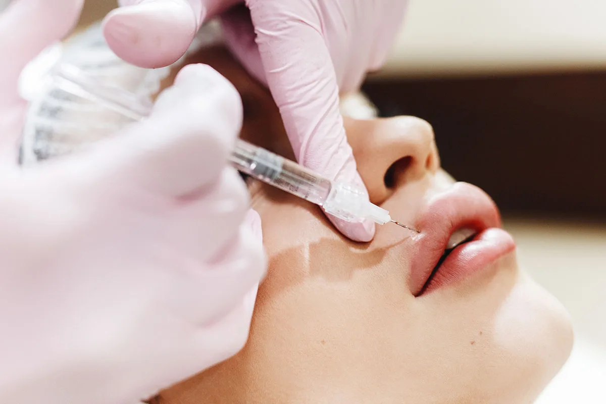 Injection d'hyaluronidase pour dissoudre l'acide hyaluronique